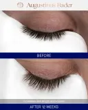 Сыворотка для роста и укрепления бровей и ресниц Augustinus Bader The Eyebrow & Lash Enhancing Serum, 8 мл — фото 6
