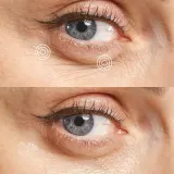 Корректор для кожи вокруг глаз Skin Office Paris Eye Recipe, 20 мл — фото 5