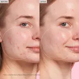 Сыворотка с ретинолом Glow Recipe Blackberry Retinol, 30 мл — фото 4