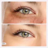 Корректор для глаз Tarte Shape Tape Radiant Concealer — фото 2