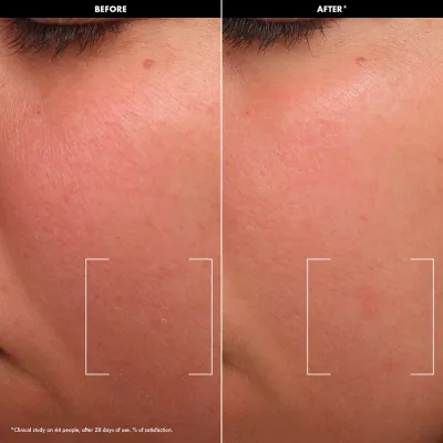 Sephora Collection HYDRATE успокаивающий бальзам-крем с липидами и церамидами 50 мл
