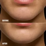 Маски для лица - инструмент для очищения угрей и пор Benefit Cosmetics The POREfessional Degunker, 22 мл — фото 2