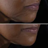 Clinique Smart Clinical Repair Lift Cream Крем для лица и шеи 50 мл — фото 2