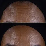 Clinique Smart Clinical Repair Lift Cream Крем для лица и шеи 50 мл — фото 3
