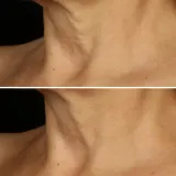 Clinique Smart Clinical Repair Lift Cream Крем для лица и шеи 50 мл — фото 4