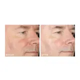 Ежедневный пилинг с интенсивной формулой Dr Dennis Gross Alpha Beta, оттенок 5 процедур — фото 2