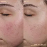 Крем для зрелой кожи лица, проблемная кожа BYOMA Blemish Control Moisturizer, 50 мл — фото 2