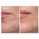 Крем против несовершенств для зрелой кожи лица The Ordinary Concentrate of sulfur cream in powder 10%, 5 г — фото 3