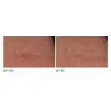Интенсивный крем против морщин для ночного ухода Dr Dennis Gross Advanced Retinol + Ferulic, 30 мл — фото 4