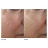 Концентрированная сыворотка для упругости кожи Dr Dennis Gross Advanced Retinol + Ferulic, 30 мл — фото 2