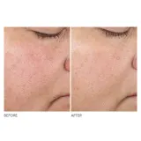 Концентрированная сыворотка для упругости кожи Dr Dennis Gross Advanced Retinol + Ferulic, 30 мл — фото 3
