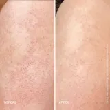 First Aid Beauty KP Smoothing Brightening Body Lotion разглаживающий лосьон для тела 200 мл — фото 5