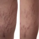 Демакияж для глаз Augustinus Bader The Body Cream, 100 мл — фото 5