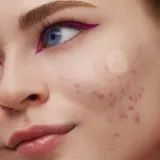 Крем для зрелой кожи лица, проблемная кожа Peace Out Skincare Patches for imperfections, 8 plastrów — фото 3