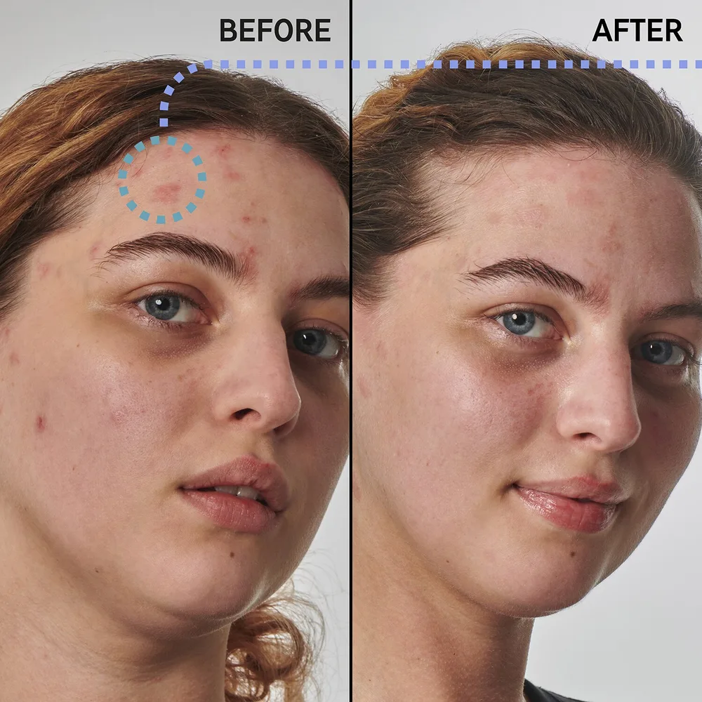 Сыворотка для лица The Inkey List 10% Urea Moisturizer, 50 мл