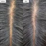 Увлажняющая и освежающая маска для кожи головы Briogeo Scalp Revival, 177 мл — фото 3