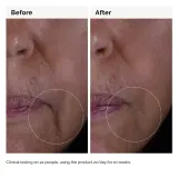 Сыворотка против старения The Ordinary Solution GF 15%, 30 мл — фото 3