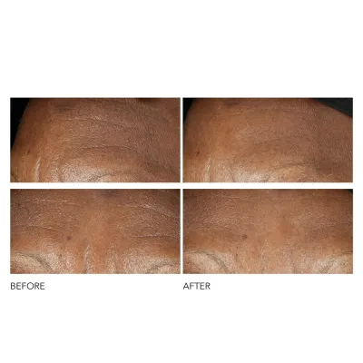 Интенсивный крем против морщин Dr Dennis Gross Advanced Retinol + Ferulic, 60 мл