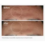 Сыворотка против несовершенств The Ordinary Niacynamid 10% + Cynk 1% — фото 3