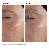 Тоник для лица The Ordinary Glycolic acid 7% toner — фото 4