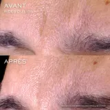 Сыворотка для лица Lancôme — фото 5