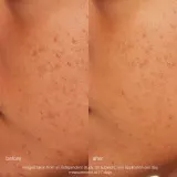 Пилинг для лица Dermalogica — фото 3