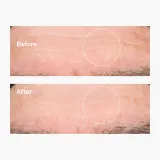 Сыворотка для лица: Увлажняющая сыворотка The Ordinary Kwas Hialuronowy 2% + B5 — фото 4