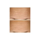 Концентрированная сыворотка 15% витамина C для упругости и сияния Dr Dennis Gross Vitamin C + Lactic, 30 мл — фото 5