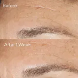 Активный пилинг для лица Murad Replenishing Multi-Acid Peel, 100 мл — фото 3
