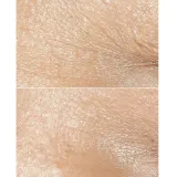Clinique Smart Clinical Repair Wrinkle Correcting Cream Крем для лица от морщин, 50 мл — фото 2
