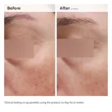 The Ordinary Niacinamide 5% Emulsion лёгкая эмульсия для лица и тела 100 мл — фото 2