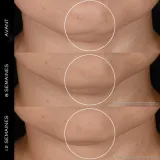 Крем для лица против морщин и для лифтинга Lancôme Rénergie H.P.N. 300-Peptide Cream — фото 2