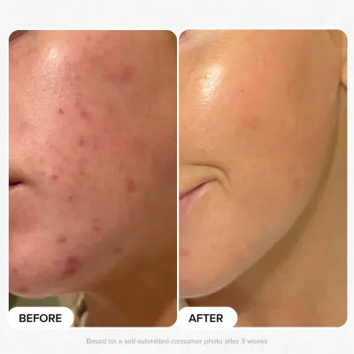 Paula's Choice The Plump and Glow Kit набор эксфолиант с 2% BHA и крем-гель с пептидами 30 мл + 15 мл