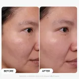 Paula's Choice Clinical сыворотка для лица с 20% ниацинамида 20 мл — фото 2