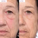 Glow Recipe Prickly Pear сыворотка для лица с пептидом муцина 40 мл — фото 5