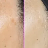 Lightinderm Spotless сыворотка-капсулы для лица против пигментных пятен 4 x 2,1 мл — фото 4