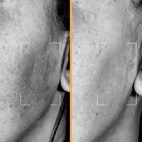 Lightinderm Brightening — сыворотка в капсулах с ниацинамидом, андрографисом и витамином C, 4 x 2,1 мл — фото 4