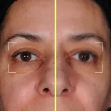 Lightinderm Eye сыворотка в капсулах для кожи вокруг глаз с пептидами, кофеином и ниацинамидом, 4 x 2,1 мл — фото 4
