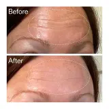 The Inkey List Starter Retinol Serum сыворотка для лица с ретиноидами 30 мл — фото 3