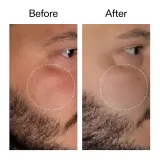 The Inkey List Starter Retinol Serum сыворотка для лица с ретиноидами 30 мл — фото 4