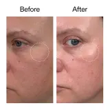 The Inkey List Advanced Retinal Serum — сыворотка для лица с ретиналем, 15 мл — фото 5