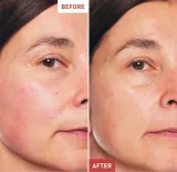 Erborian K-Beauty Skin Therapy Ritual набор ночного ухода за лицом и кожей вокруг глаз 10 мл + 5 мл — фото 2