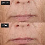 Kiehl's Since 1851 Midnight Recovery Concentrate ночной концентрат для лица 50 мл — фото 2