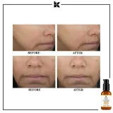 KIEHL'S Powerful-Strength Line-Reducing сыворотка для лица с витамином C и гиалуроновой кислотой от морщин 50 мл Kiehl's Since 1851 Powerful-Strength Line-Reducing — фото 2