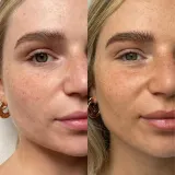 Tan Luxe The Face капли-автозагар для лица оттенок Clair/Moyen 30 мл — фото 3