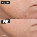 KIEHL'S Retinol Skin-Renewing Daily Micro-Dose сыворотка для лица с ретинолом, церамидами и пептидами, антивозрастной уход, 50 мл Kiehl's Since 1851 Retinol Skin-Renewing Daily Micro-Dose Treatment — фото 2