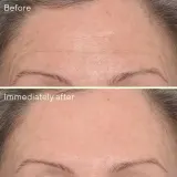 Murad Targeted Wrinkle Corrector Сыворотка для разглаживания морщин 15 мл — фото 2