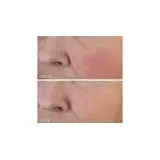 Dr Dennis Gross Vitamin C + Lactic крем для лица увлажняющий с витамином C и молочной кислотой, 60 мл — фото 4