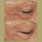 Origins Plantscription Wrinkle Correction крем для кожи вокруг глаз с ретинолом 15 мл — фото 2