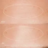 Dermalogica Liquid Peelfoliant жидкий пилинг для лица 59 мл — фото 5